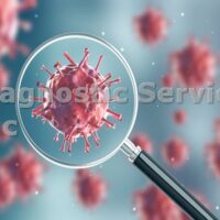 Hepatitis A – B – C – E