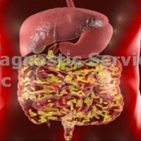 gastroenterology and infections