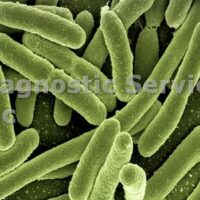 sepsis and suspected bacterial infections